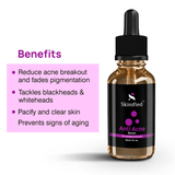 Anti Acne Serum 30ML
