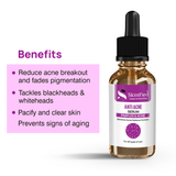 Anti Acne Serum 30ML