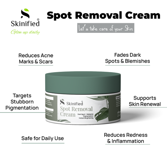 Spot Removal Cream (Dark Spot, Anti Acne, Acne Marks)